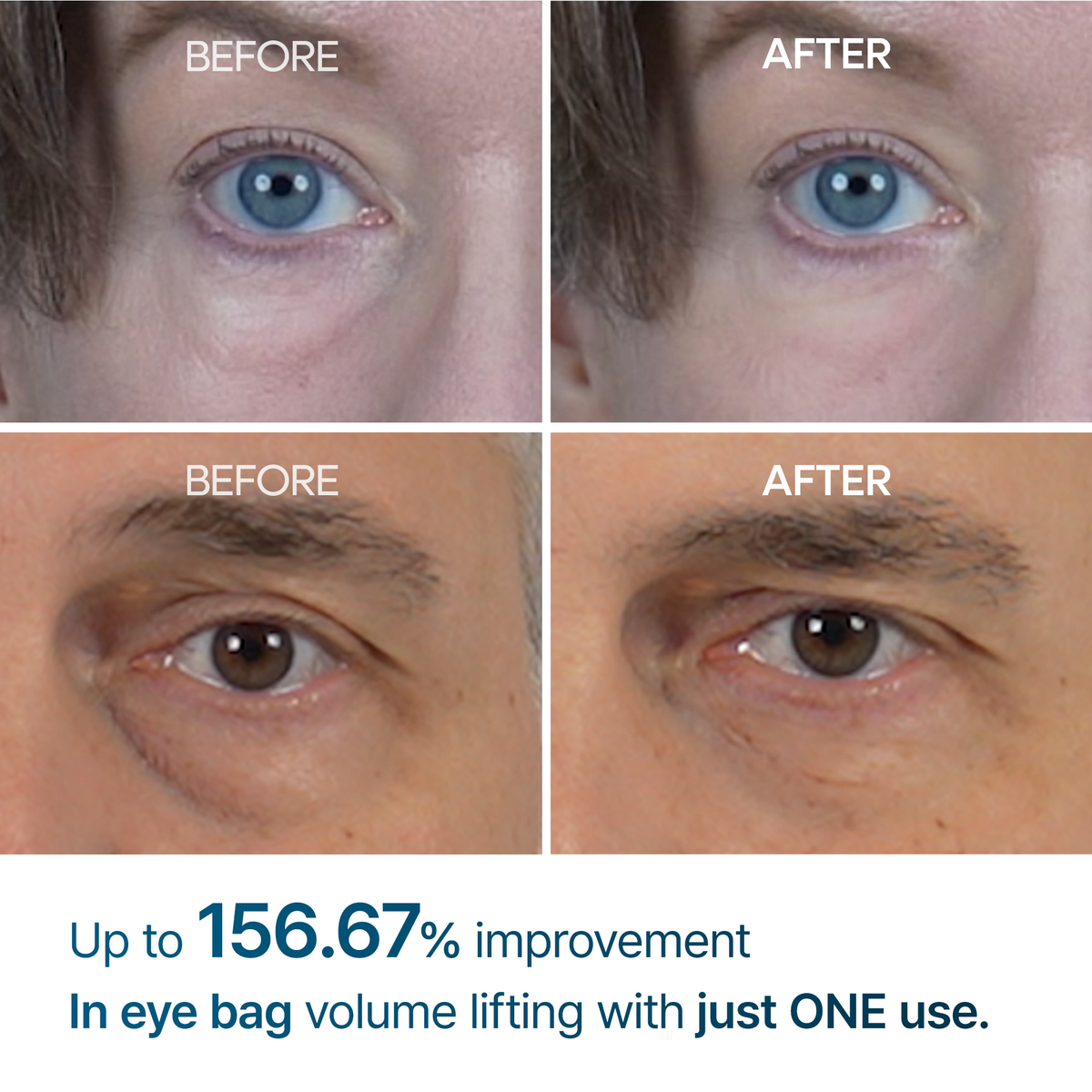 👉 Alcuras™ Advanced Firming Under-Eye Cream | Visibly Lifts Eye Bags & Dark Circles